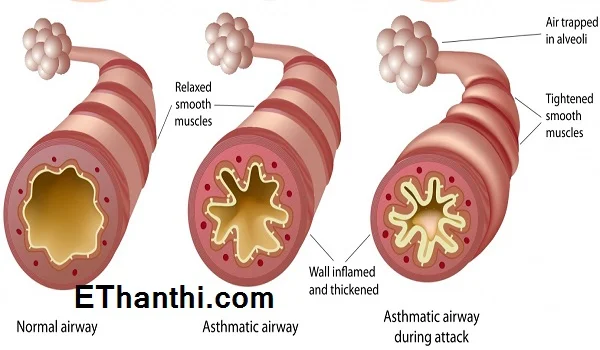 அதிகளவில் மெக்னீசியம்