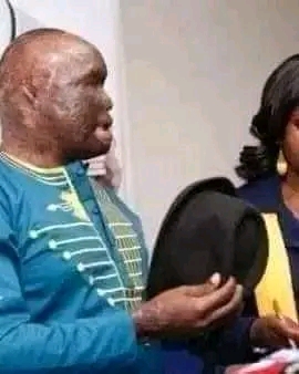 HIS WIFE POURED ACID SOLUTION AFTER A SMALL ARGURMENT