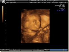 BABY_16