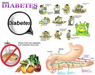 Gejala Diabetes Melitus