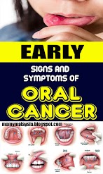 What Are Early Signs Of Cancer In Dogs - Beautyglife » EARLY WARNING SIGNS OF CANCER : Cancer in dogs can be quite common for those aged over 10.