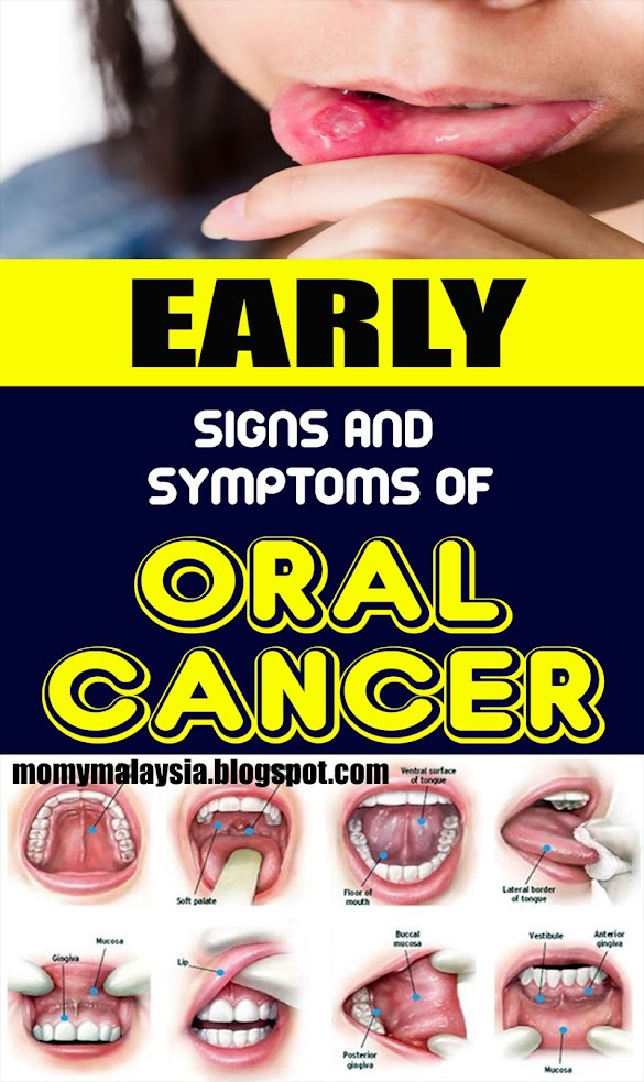 What Are Early Signs Of Cancer In Dogs - Beautyglife » EARLY WARNING SIGNS OF CANCER : Cancer in dogs can be quite common for those aged over 10.