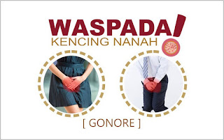 RESEP ALAMI MENGATASI VAGINA KELUAR NANAH BERWARNA BENING