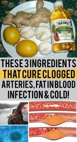 Three Ingredients That Can Cure Clogged Arteries, Blood Fats, Infections And Colds