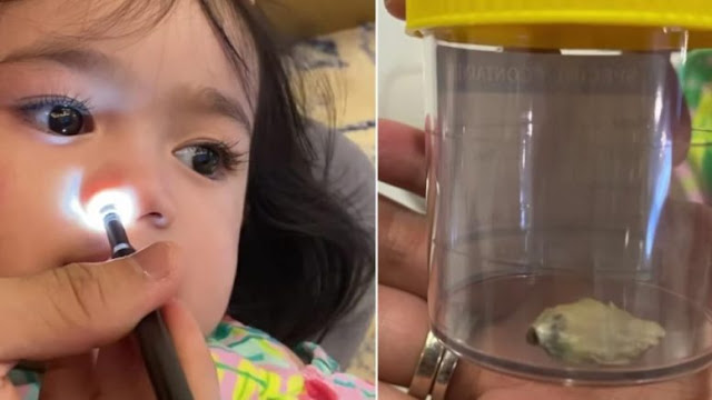 “Alisa tunjuk hidung and kata sakit sakit!” Rupanya Ada Benda Ni Dalam Hidung !