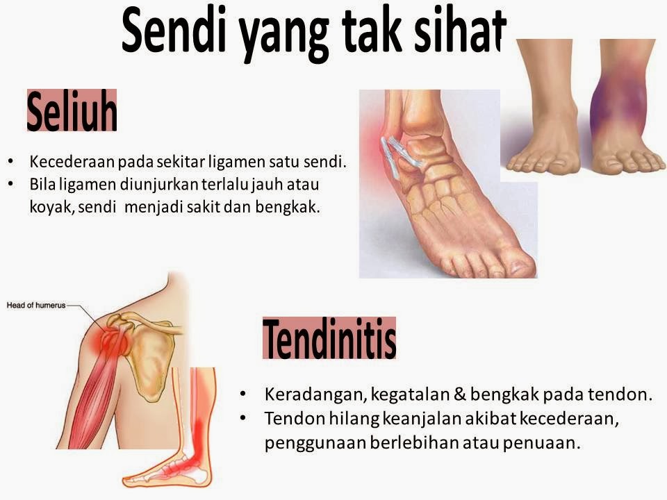 http://penjualanobatherbalalami.blogspot.com/2014/03/kisah-sembuh-dari-penyakit-nyeri-sendi.html