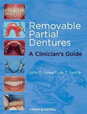 Removable Partial Dentures A Clinician's Guide, 1E 