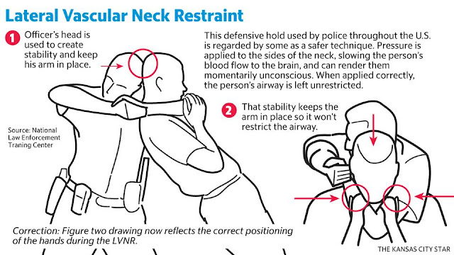 Lateral Vascular Neck Restraints (LVNR)