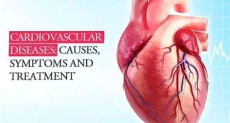  Cardiovascular Disease, Symptoms and Treatment