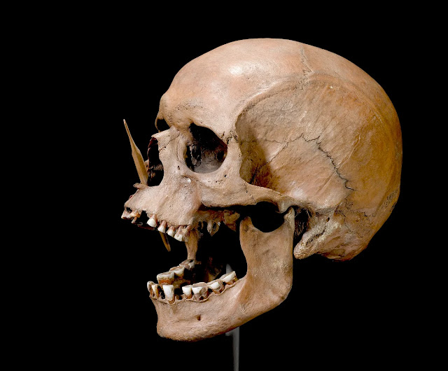Ο άνθρωπος Porsmose που χρονολογείται τη Νεολιθική περίοδο και βρέθηκε με ένα κεφάλι βέλους στη μύτη το 1947 στην περιοχή Porsmose της Δανίας συμπεριλήφθηκε στην ερευνητική προσπάθεια ανάλυσης του DNA. [Credit: The Danish National Museum]