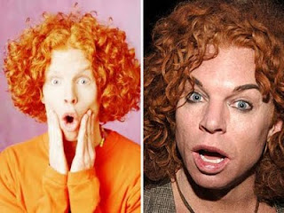 Carrot Top Plastic Surgery gone bad before after