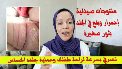 . يلطف ويعالج الجلد المتضرر. يحمي الرضيع من التاتيرات الخارجية