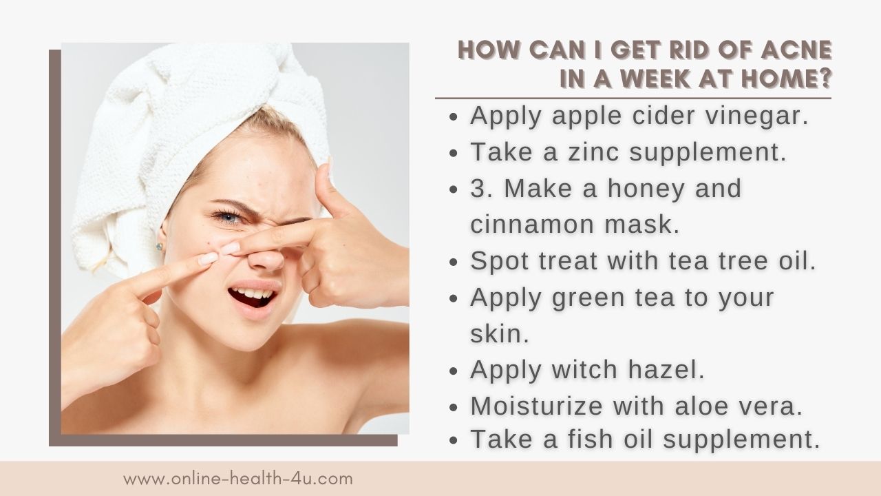 how-to-get-rid-of-acne-in-a-week-with-home-remedies