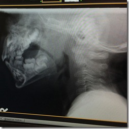 xray xray
