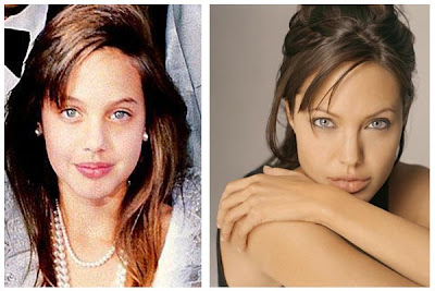 Angelina Jolie Plastic Surgery