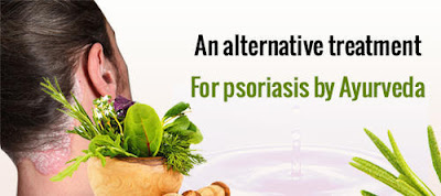 Ayurvedic medicine for psoriasis 