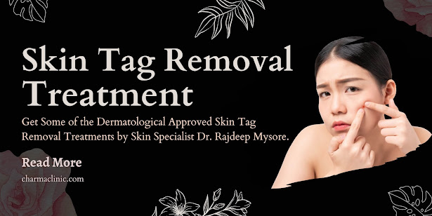 best dermatologist in Bangalore