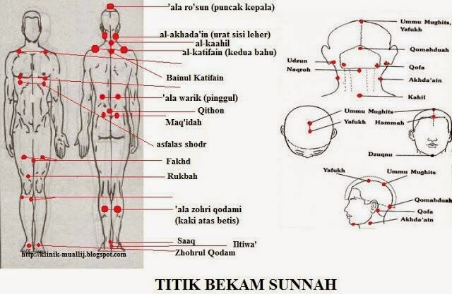  Apa Kelebihan Berbekam ?