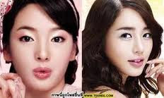 หมอศัลยกรรมเปลี่ยนโหงวเฮ้งดาราดัง Surgery Physiognomy