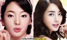 หมอศัลยกรรมเปลี่ยนโหงวเฮ้งดาราดัง Surgery Physiognomy