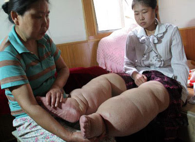 wang cheng's thich leg