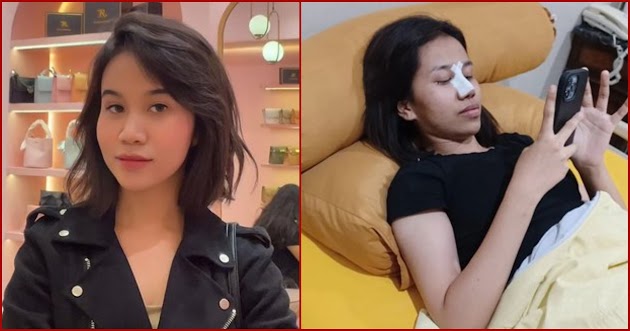 Diduga Lakukan Operasi Hidung, Ini Penampakan Terbaru Mayang Adik Mendiang Vanessa Angel