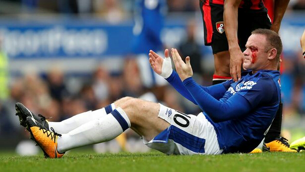 Wayne Rooney Surfers Eye Injury During Clash With Bournemouth (See Photos) 