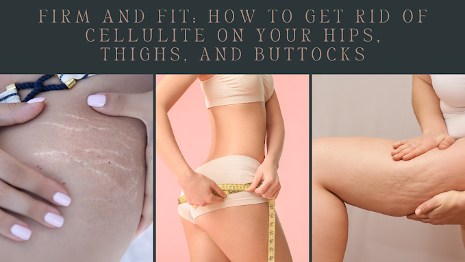 cellulite, cellulite treatment, anti cellulite, cellulite on legs, butt dimples, cellulite removal, get rid of cellulite, cellulite on thighs, best way to get rid of cellulite,