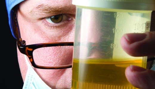 Urine Testing