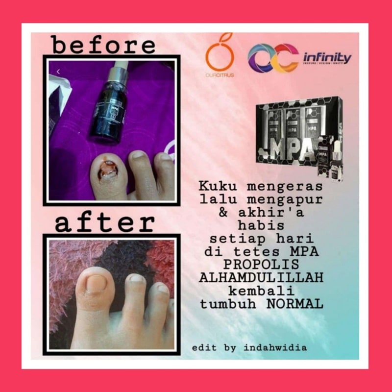 testimoni mpa propolis-56