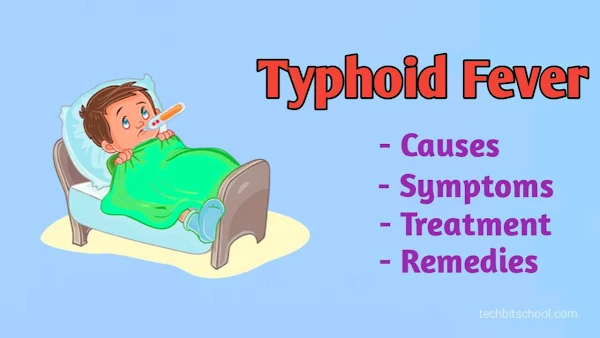 Typhoid Fever: Causes, Symptoms, Treatment & Remedies