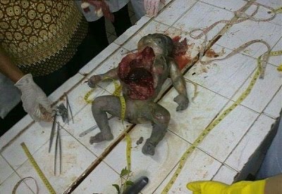BLOG USANG: [ 10 gambar ] Gambar Post Mortem Bayi Di Bilik 