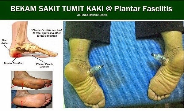 MAKLUMAT KESIHATAN DAN PENYAKIT: TITIK BEKAM