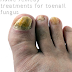 Nail Fungus Home Remedy, Toenail Fungus Home Remedies, Home Remedy for Nail Fungus