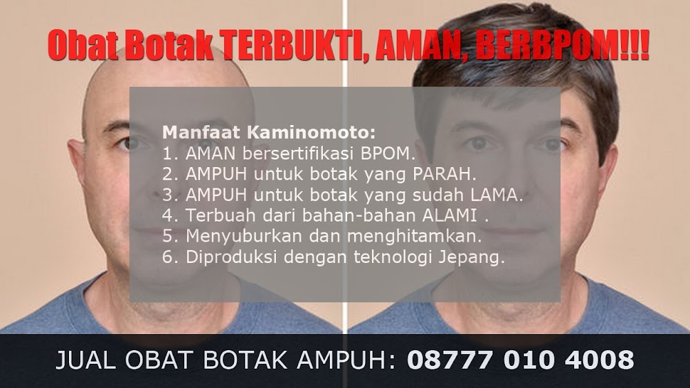 VIDEO CARA MENUMBUHKAN RAMBUT<br/>Tanjungbalai<br/>