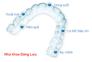 Ưu điểm của niềng răng khay trong suốt