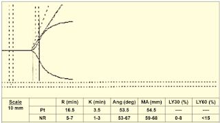 Viscoelastic Measures of Coagulation