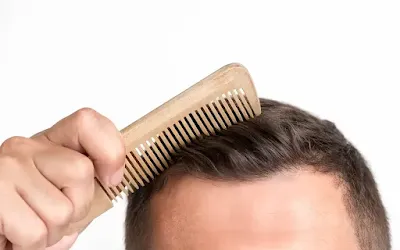 An infographic highlighting various hair loss treatments, including medications, medical procedures, and lifestyle changes, with illustrations of each method.  Hair loss treatment, best hair loss remedies, minoxidil, finasteride, hair transplant, PRP therapy, laser therapy for hair loss, natural hair loss remedies.