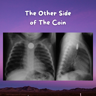 This blog focuses on swallowed foreign bodies, with a focus on those lodged in the esophagus, like a coin.