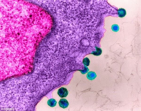 Vacina contra o HIV promete retirar os vírus das células para o sistema imunológico destruí-los