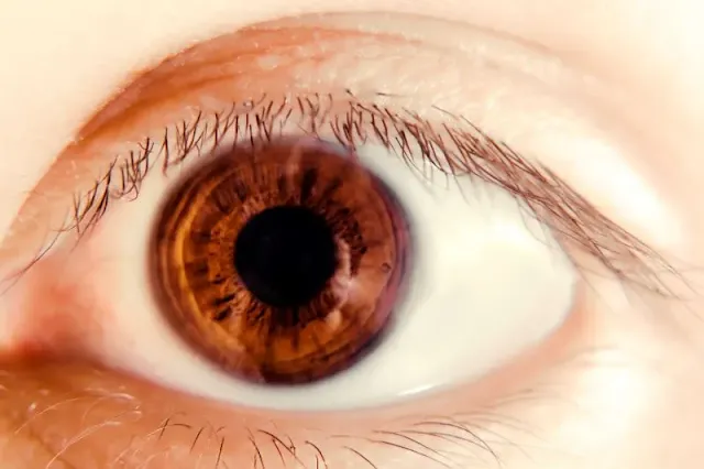 viral infection, healthy vision natural treatment, eye health tips, eye health, eye health foods, eye health matters