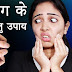 Home remedies for Leucoderma - सफेद दाग मिटाने के घरेलू उपाय