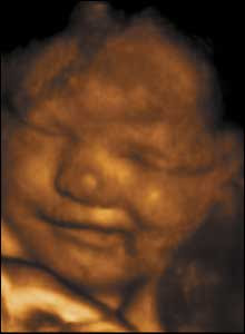 Embarazo: semanas 9 a 17. Cambios en el embrion. La modificacion ya no lo llamamos embrion ahora lo llamamos feto. Como cambia nuestro bebe. Modificaciones en el organismo. Semana 9, 10, hasta la 17. Primer trimestre de embarazo. Pasamos al segundo trimestre. Concepcion. cuidados del bebe. embrion. feto. modificaciones. crecimiento. formacion de la piel. formacion de los organos vitales. como va creciendo. peso y tamaño. como se alimenta. cordon umbilical. miembros. se forma su carita. perfil. ecografias. examenes clinicos. padres y madres. planificacion familiar. enfermedades. problemas en el embarazo. trastornos y a nomalias. proteccion infantil. hermanos. familias. crecimiento familiar. quiero tener un hijo. cuando tener un hijo. relaciones sexuales. sexualidad. sexo del bebe. la decision de ser padres. primeras ocho semanas, qua hacer antes de quedar embarazada, fecha de nacimiento. fecundacion. higiene. cambios en la madre. Enfermedades de transmisión sexual. Embarazo: semanas 9 a 17. Cambios en el embrion. La modificacion ya no lo llamamos embrion ahora lo llamamos feto. Como cambia nuestro bebe. Modificaciones en el organismo. Semana 9, 10, hasta la 17. Primer trimestre de embarazo. Pasamos al segundo trimestre. Concepcion. cuidados del bebe. embrion. feto. modificaciones. crecimiento. formacion de la piel. formacion de los organos vitales. como va creciendo. peso y tamaño. como se alimenta. cordon umbilical. miembros. se forma su carita. perfil. ecografias. examenes clinicos. padres y madres. planificacion familiar. enfermedades. problemas en el embarazo. trastornos y a nomalias. proteccion infantil. hermanos. familias. crecimiento familiar. quiero tener un hijo. cuando tener un hijo. relaciones sexuales. sexualidad. sexo del bebe. la decision de ser padres. primeras ocho semanas, qua hacer antes de quedar embarazada, fecha de nacimiento. fecundacion. higiene. cambios en la madre. Enfermedades de transmisión sexual. Embarazo: semanas 9 a 17. Cambios en el embrion. La modificacion ya no lo llamamos embrion ahora lo llamamos feto. Como cambia nuestro bebe. Modificaciones en el organismo. Semana 9, 10, hasta la 17. Primer trimestre de embarazo. Pasamos al segundo trimestre. Concepcion. cuidados del bebe. embrion. feto. modificaciones. crecimiento. formacion de la piel. formacion de los organos vitales. como va creciendo. peso y tamaño. como se alimenta. cordon umbilical. miembros. se forma su carita. perfil. ecografias. examenes clinicos. padres y madres. planificacion familiar. enfermedades. problemas en el embarazo. trastornos y a nomalias. proteccion infantil. hermanos. familias. crecimiento familiar. quiero tener un hijo. cuando tener un hijo. relaciones sexuales. sexualidad. sexo del bebe. la decision de ser padres. primeras ocho semanas, qua hacer antes de quedar embarazada, fecha de nacimiento. fecundacion. higiene. cambios en la madre. Enfermedades de transmisión sexual.