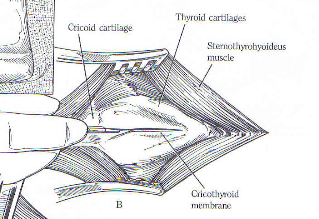 Teknik Operasi Laringotomy pada Hewan (Bedah Thoraks)