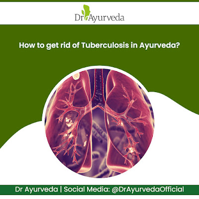 Treatment of Tuberculosis in Ayurveda