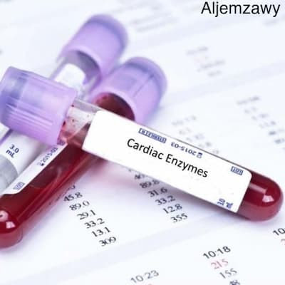 Cardiac enzymes: Symptoms, causes, test, types and treatment