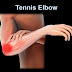 Tennis Elbow- Causes, Symptoms, Treatment and Prevention