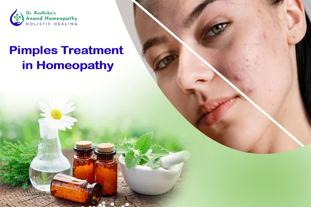 pimples_treatment