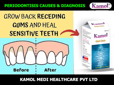 gum recession causes and treatment