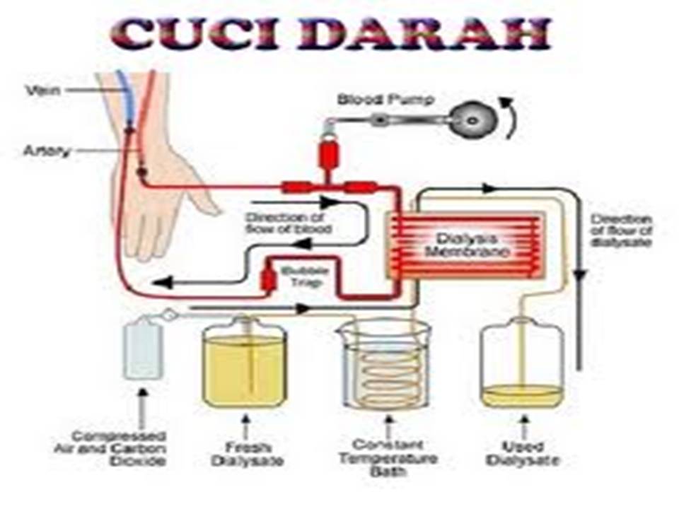 PUSAT PENYEMBUHAN TERPADU: SYSTEM EKSKRESI, KELAINAN DAN 